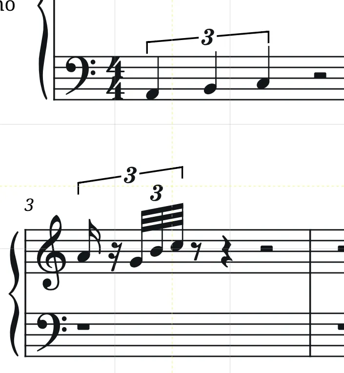 Tuplet customization